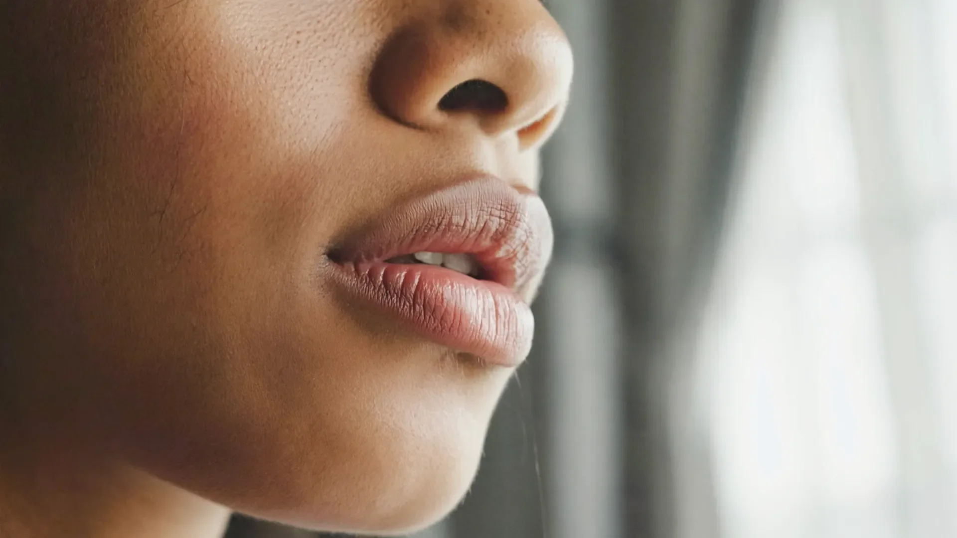 Natural, balanced lips after doctor-led lip filler