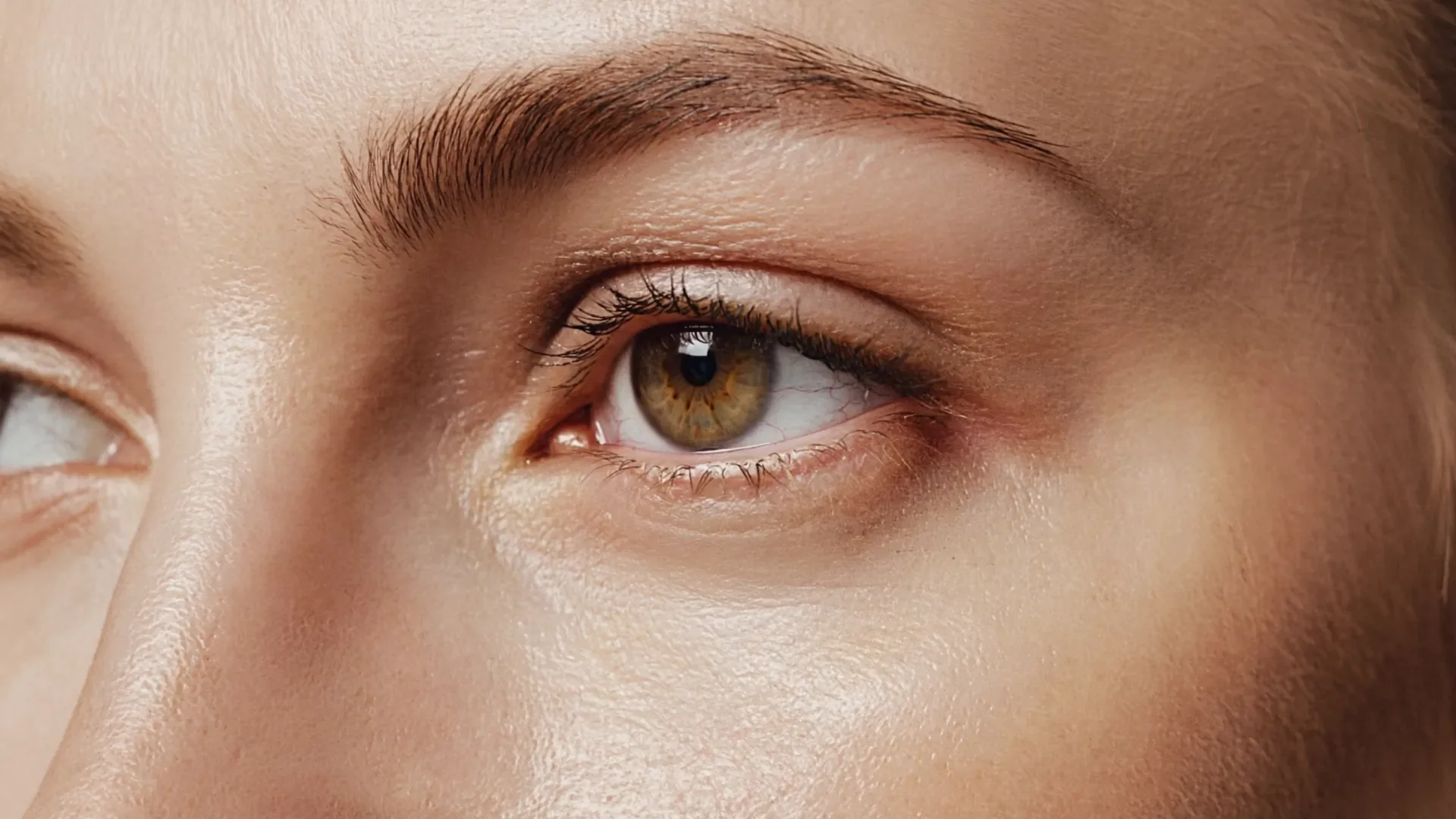 Close-up of the under-eye area, where skin-quality treatments such as polynucleotides are used in Dublin