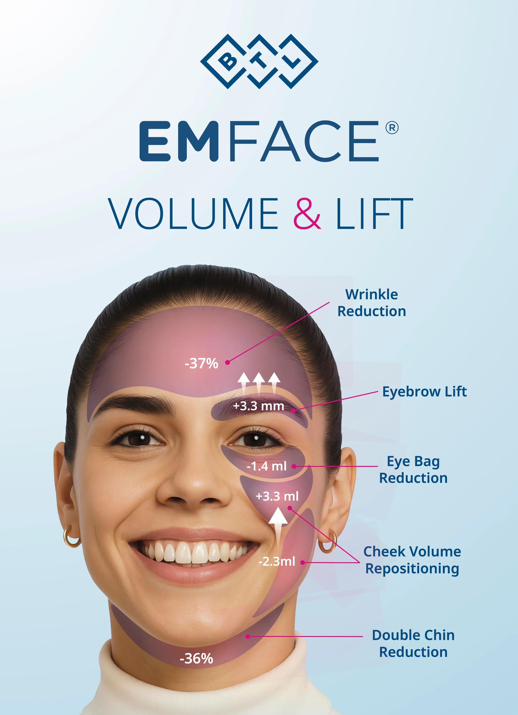 EmFace treatment data and results - Clinical data showing effectiveness of EmFace non-surgical facelift treatment
