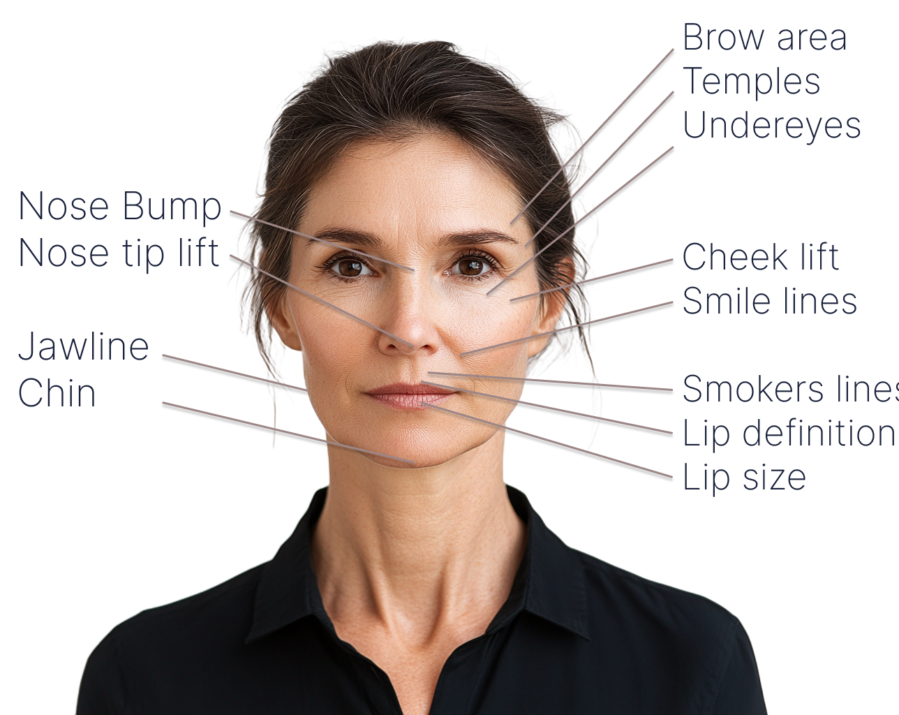 Facial areas dermal filler can treat in Dublin, including lip definition and lip size