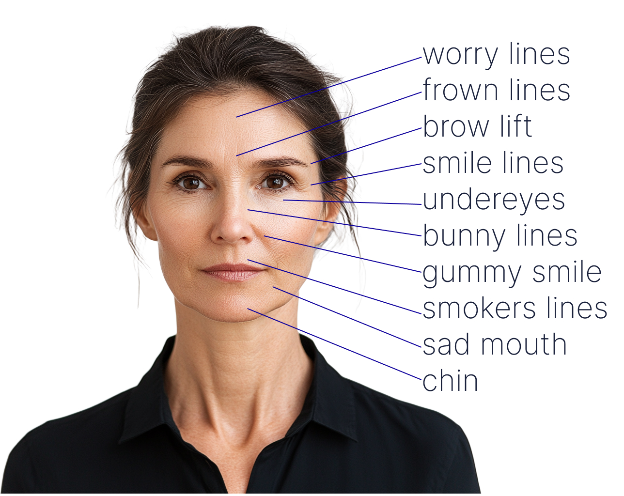 Anti-Wrinkle Treatment
